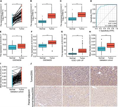 ZCCHC17 Served as a Predictive Biomarker for Prognosis and Immunotherapy in Hepatocellular Carcinoma